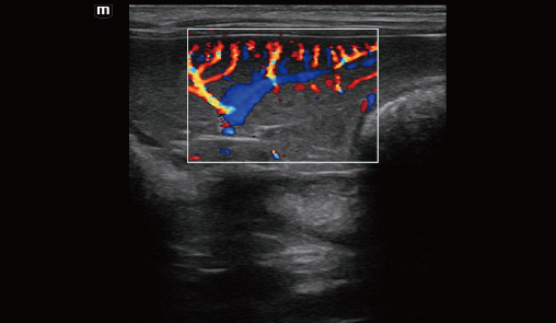 Spleen blood flow of canine